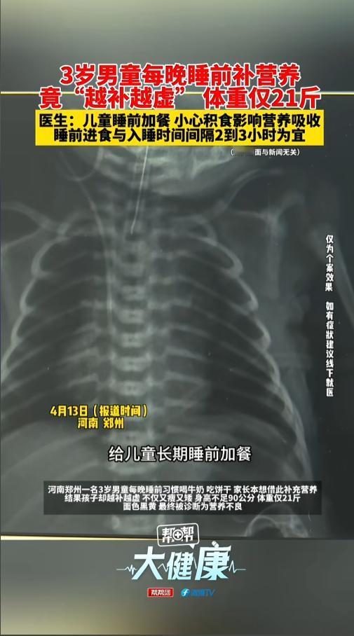 “补成了营养不良？”近日，河南郑州，家长为了给自己的孩子补充营养，长得更好，每天