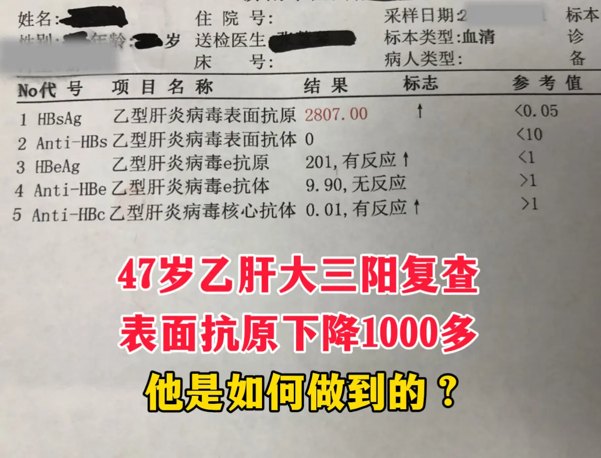 前几天门诊来了一位 47 岁的乙肝大三阳患者，刚查出乙肝的时候他心里压...