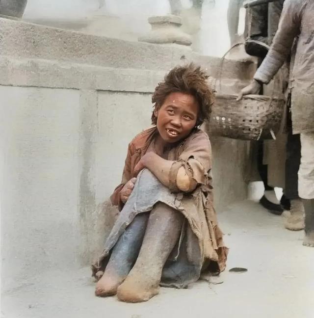 民国时期的一个麻风病人，她的双脚已经腐烂，看着挺恐怖的话说民国时候，中国麻风病