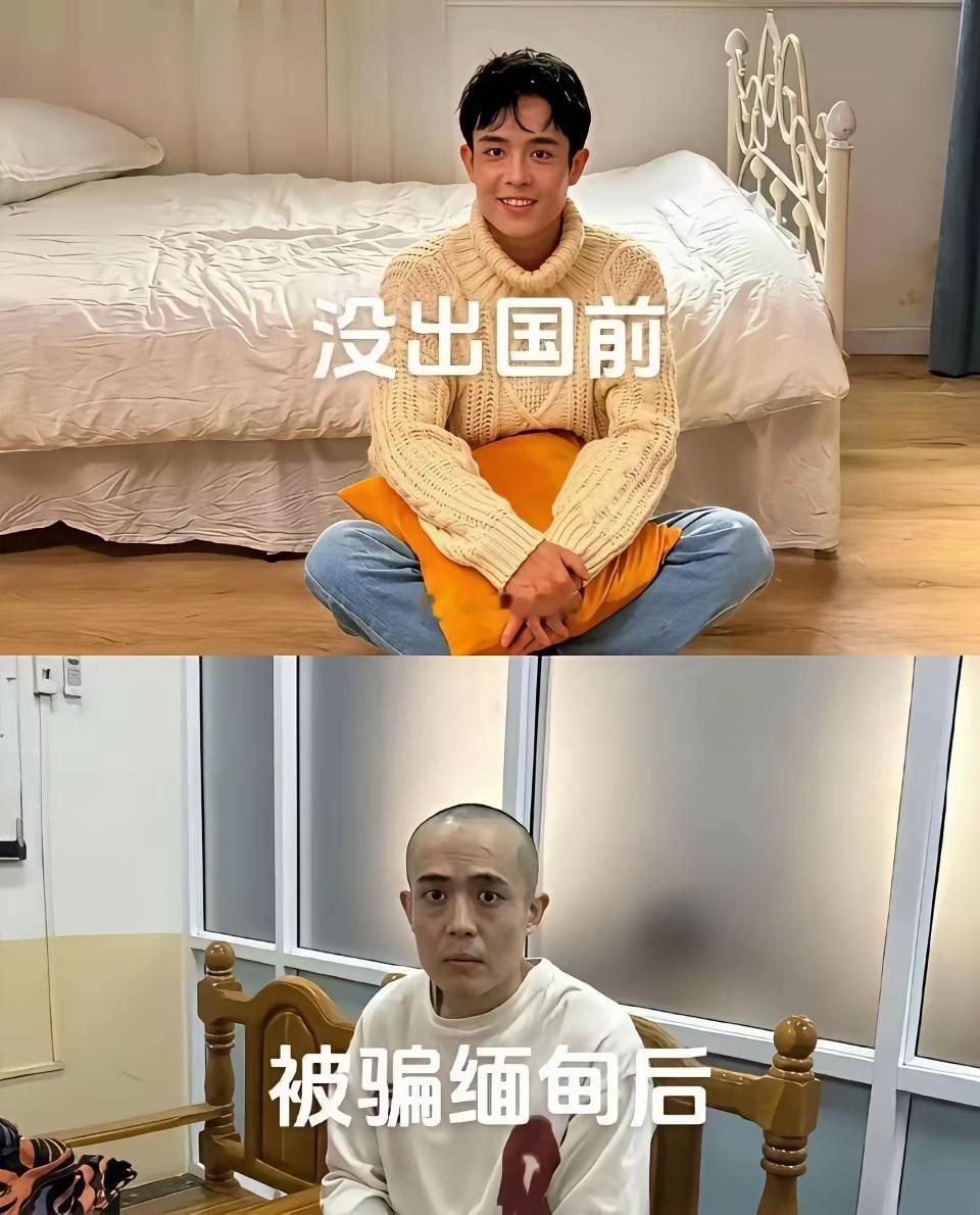 王星没被骗去缅甸前应该是个非常单纯的人所以去了一趟受了惊吓面相都被吓变了​​​​