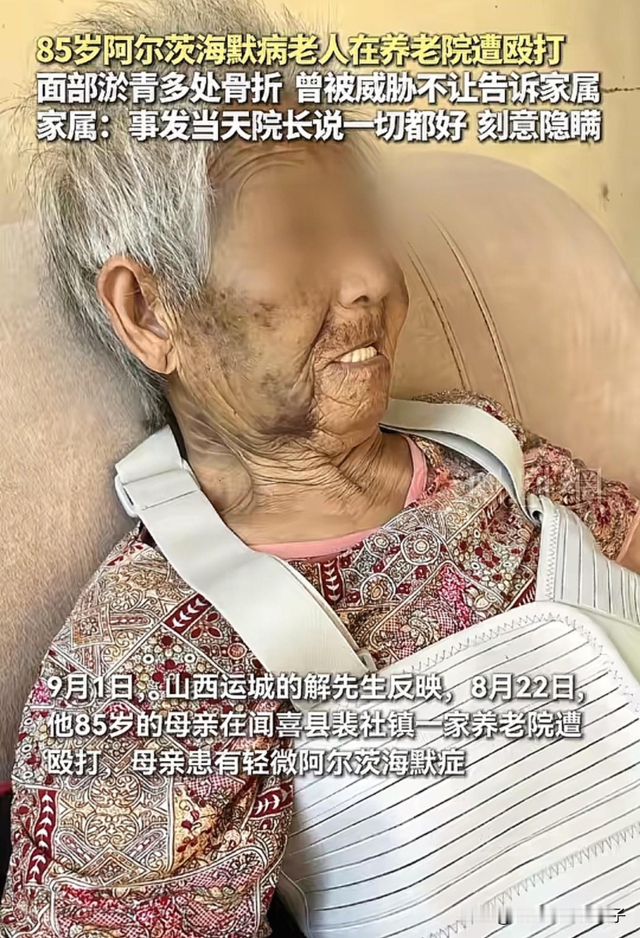 太心酸了！近日，山西运城，85岁痴呆症老人在养老院被殴打2小时，院长还瞒着家属说