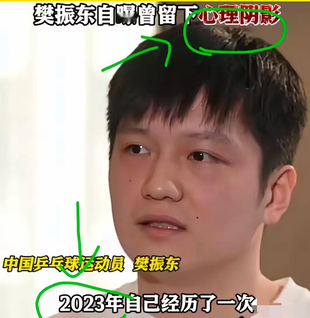 德甲俱乐部发文全力保护樊振东隐私，不公开酒店言论一出，打了谁的脸？国乒无人扛