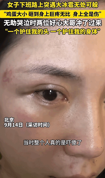 还是好人多！北京，女子下班回家的路上突遇大冰雹，因为冰雹不仅下的特别大，还来的特