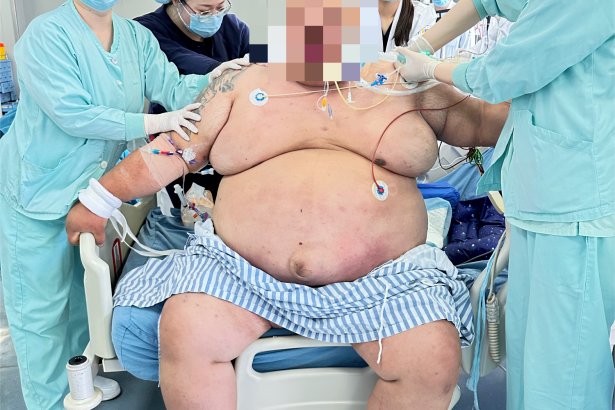 胖到无法呼吸! 410斤男子就医时突然大口喘气, 呼吸衰竭……