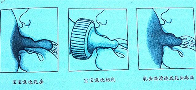 一张图让你明白, 为什么宝宝不愿吃母乳