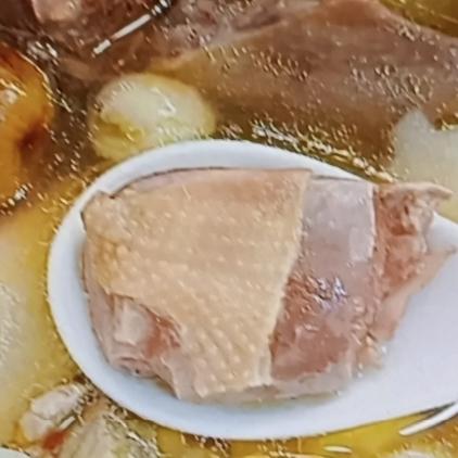 睡眠不好真的太痛苦了，我之前就总失眠，后来才知道可能是肝火旺盛。医生说多喝汤能改