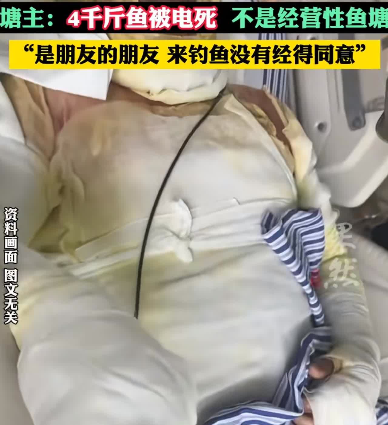 这根鱼竿一甩，小伙子的损失大了，不仅把自己完成全身80%被烧伤，还把鱼塘的鱼给电