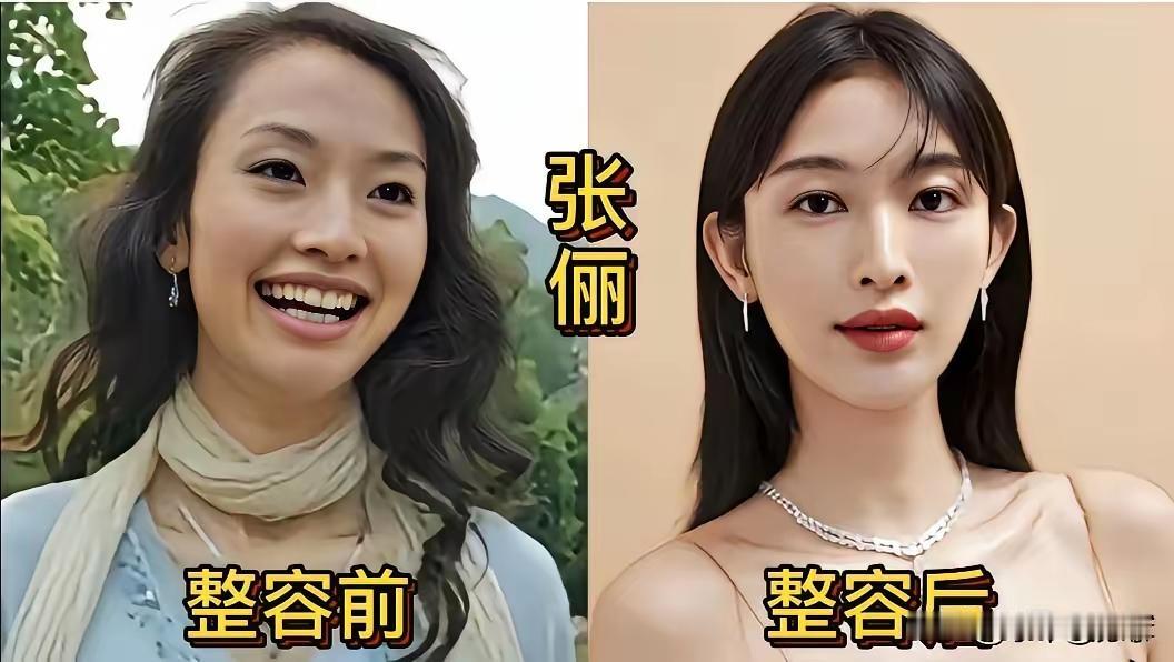 这能够大大方方承认自己整容的，其实也是一种有勇气的表现呀！我觉得熊黛林整容整的