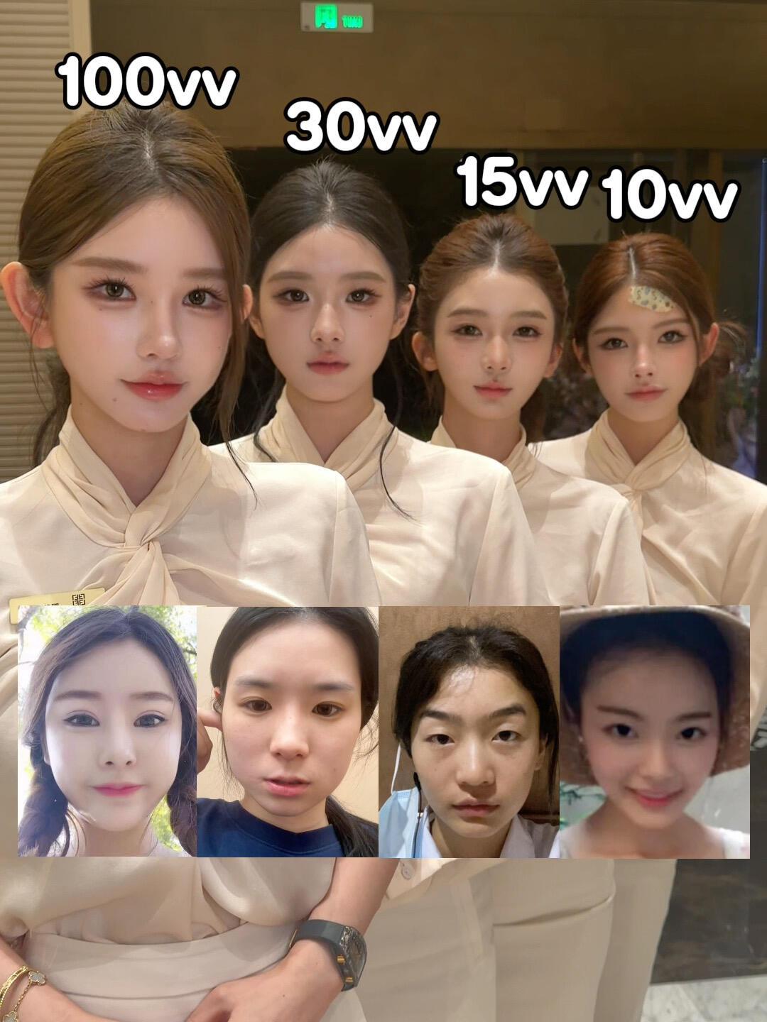 以你的审美，你觉得哪位整容整的最值？