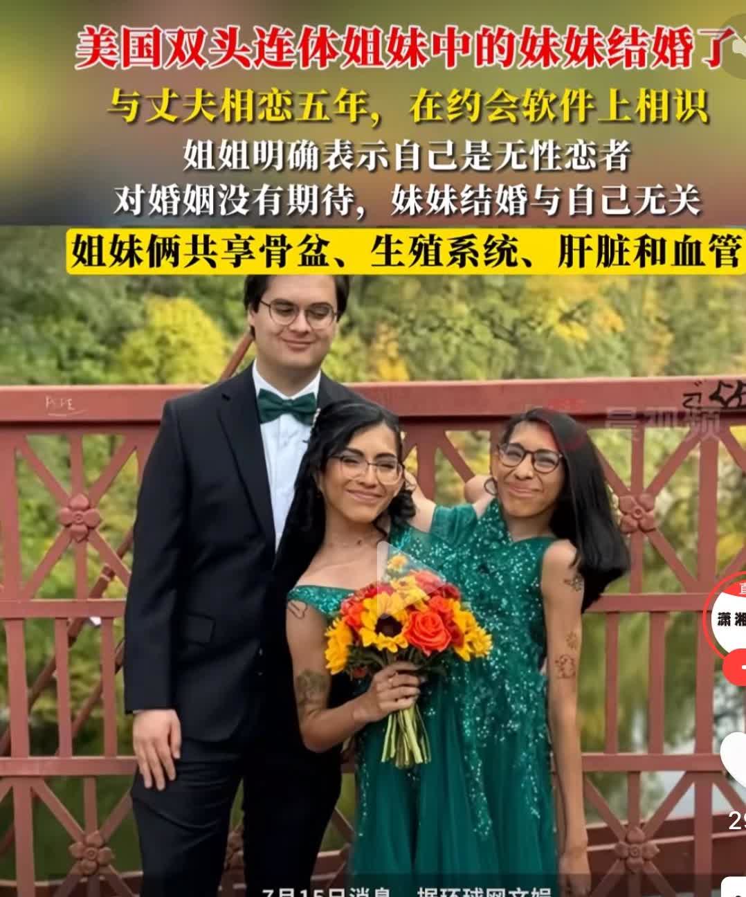 双头姐妹结婚，共用消化系统，下半身，却有两个思想，一个结婚，另一个不也相当于结婚