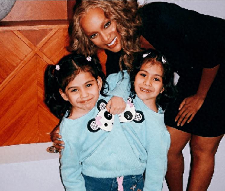 墨西哥一对连体双胞胎共享身体长达22年，姐姐交了男友后，碍于生理因素，她每次