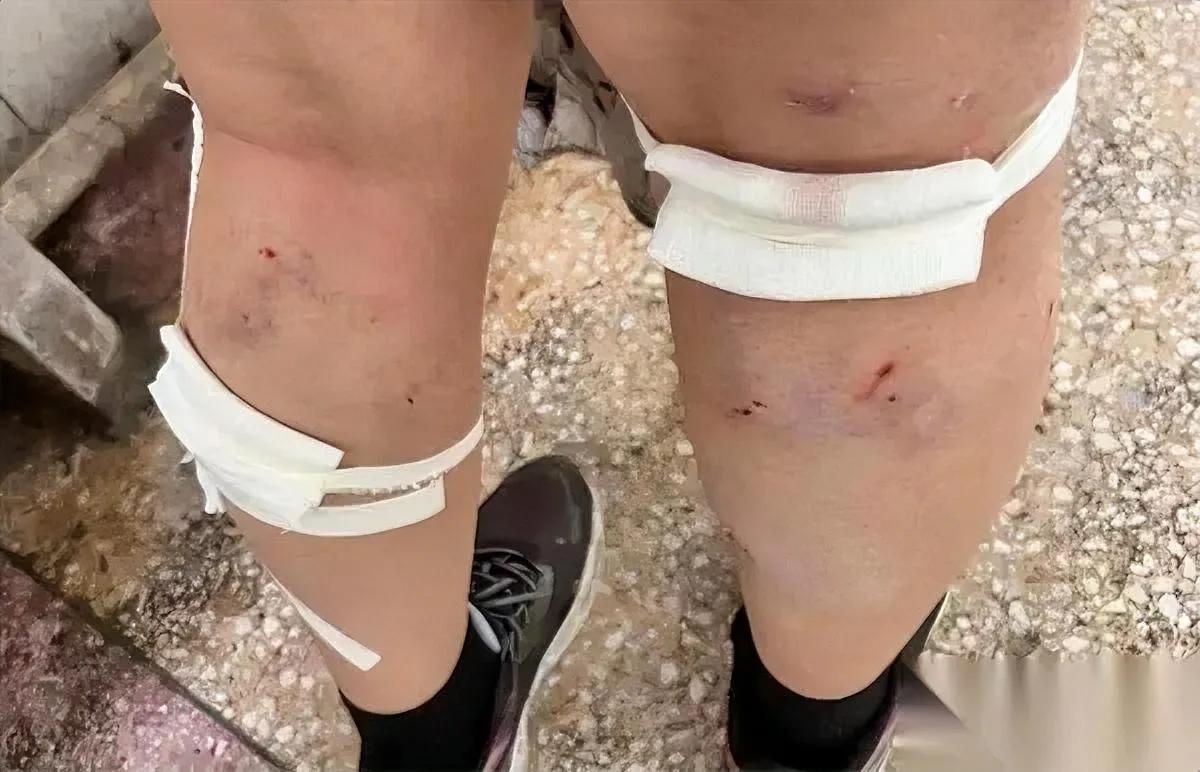 高校流浪狗出事了你敢信一群狗围咬回宿舍的学生？平顶山学院这事儿真给所