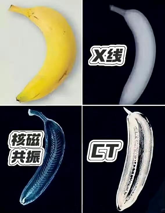 一张图教你看懂核CT、核磁共振、X光。
