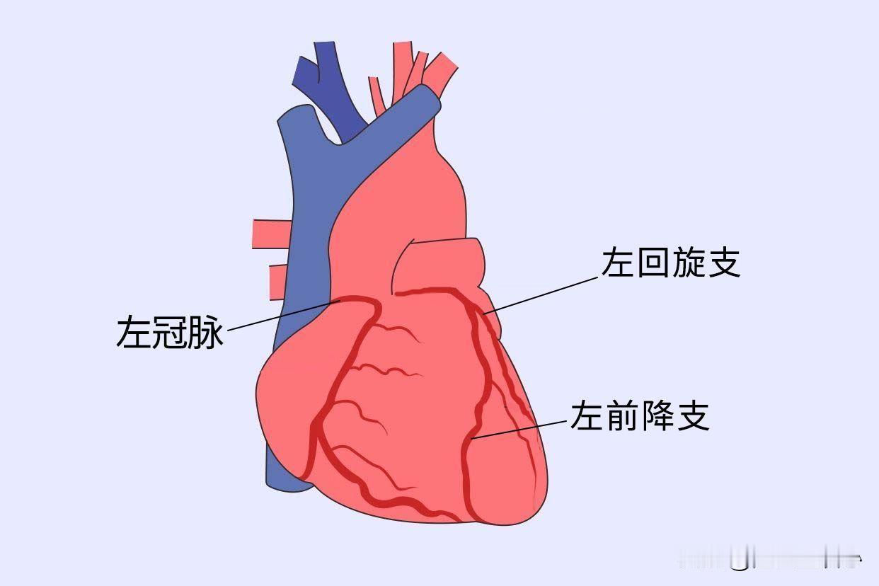 冠心病三支病变是什么给心脏供血的血管我们称之为冠状动脉，冠状动脉严重狭窄导致冠心