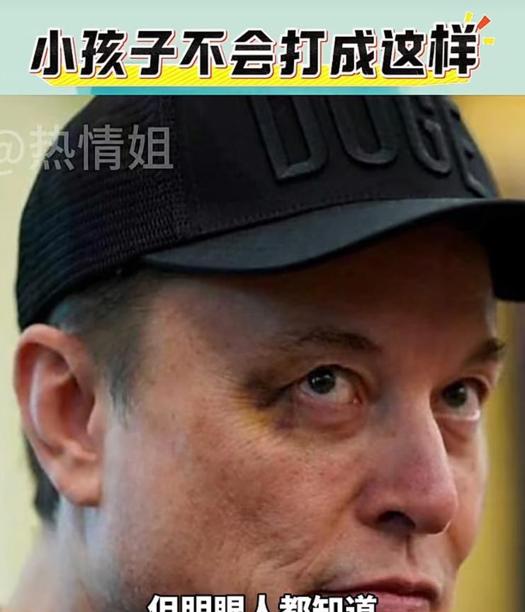 马斯克眼角淤青，他回答别人的质疑，说是被儿子打的，但是，儿子哪来这么大力气，不过
