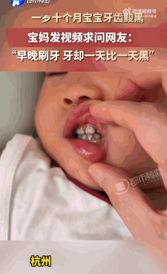 世界之大无奇不有！浙江，女子家里有个1岁10个月大的小宝贝，平时对待孩子的口腔卫