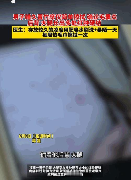 太吓人了！福建，一男子天热图省事，把放了一年的竹席拿出来，随便擦了擦就直接躺了上