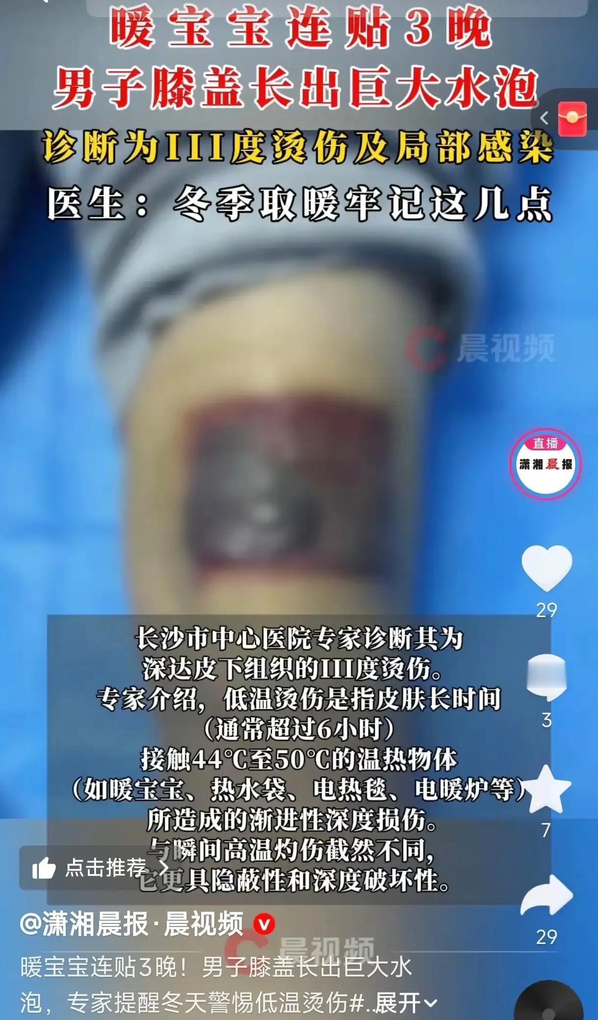 “悲剧还是发生了！”湖南长沙，38岁的张先生最近总觉得膝盖酸痛，想着暖宝宝能活血