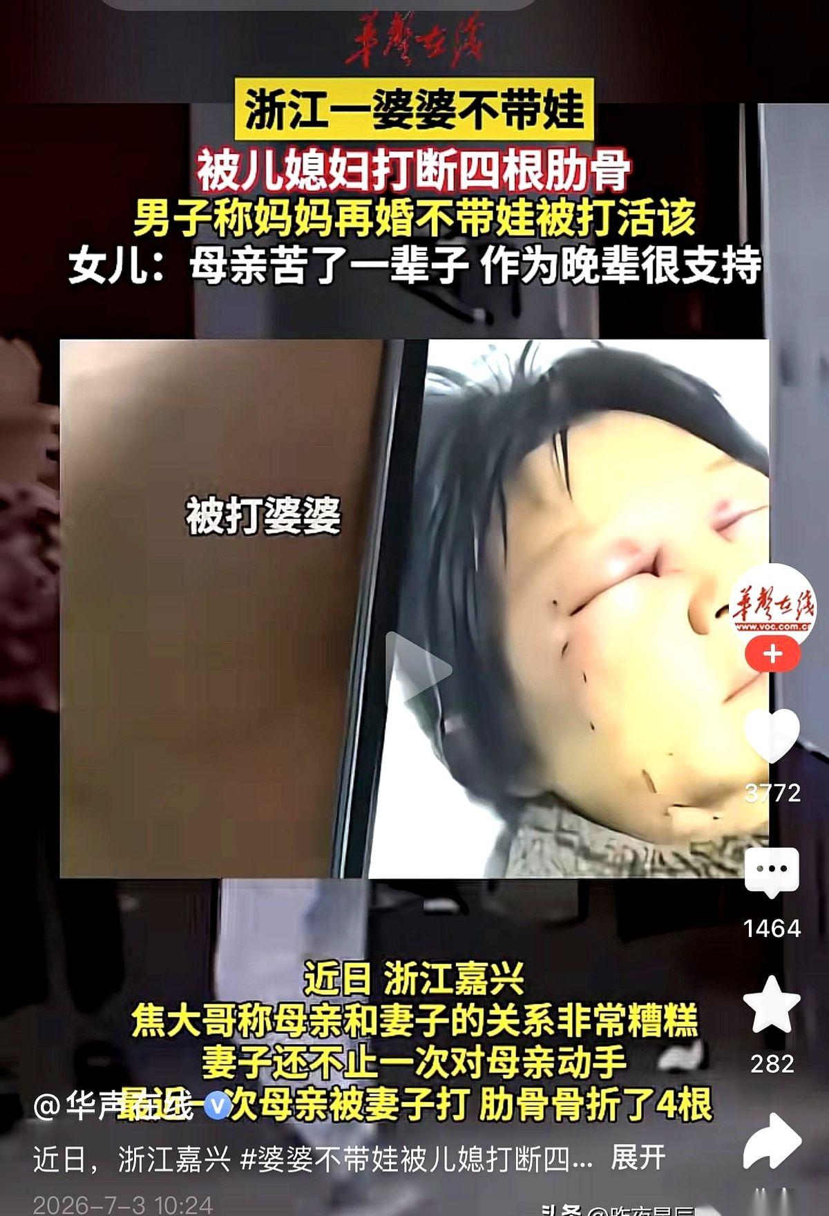 婆婆被儿媳打断四根肋骨。最扎心的不是这个，是儿子站出来说：我妈也有问题。评论