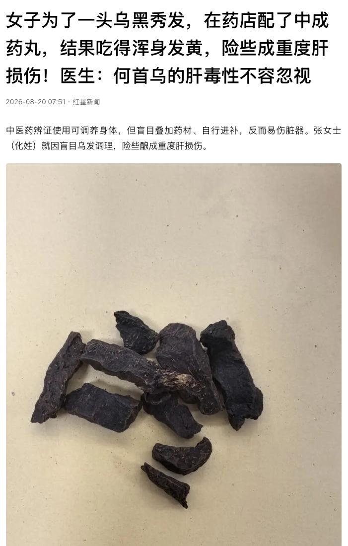 乱补的下场！浙江宁波，一名50岁女子为少长白发，在药店配了药丸，又同时服用治疗关