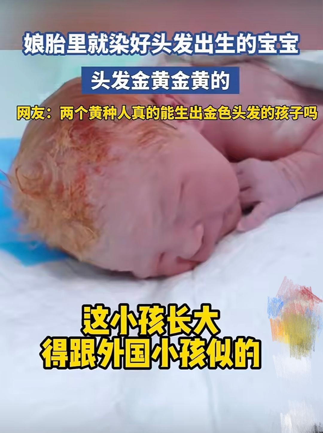 父母都是中国人，却生出个头发金黄的孩子，这合理吗？宝宝头发金黄金黄的。孩子的