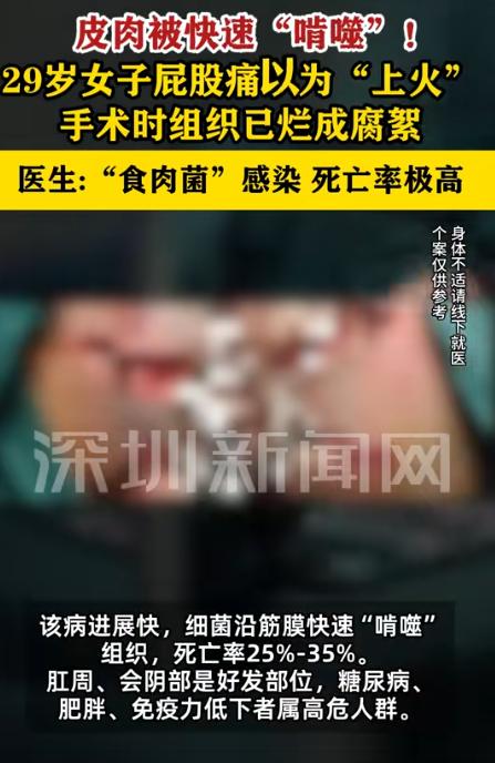 “悲剧还是发生了！”7月24日红星新闻报道，浙江，一女子肛周肿痛，她只当是普通上