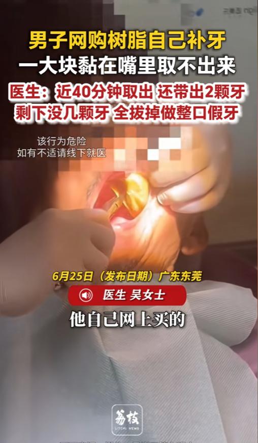 “万万没想到！”6月25日报道，广东东莞，一男子为了省钱，网购了树脂自己给自己补