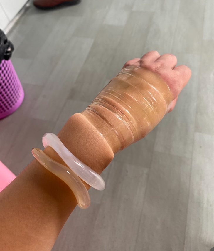 谁来救救我！新买的手镯取不下来了手捆成这样也不行，勒的不成样子老公让