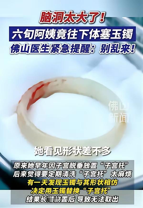 聪明反被聪明误，广东，一65岁阿姨因为“阴道异物”去医院检查，结果医生发现里面竟