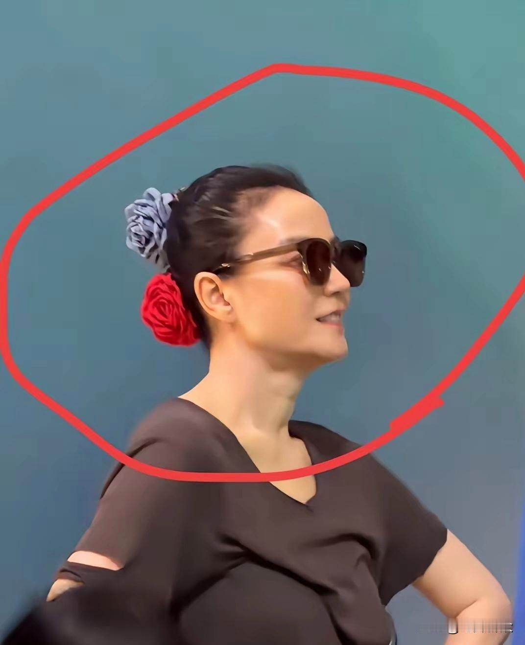 天后王菲扎起头发那一刻，头皮上的真相藏不住了。2026年8月底，阿那亚音乐节。王菲现身，不是开唱，是