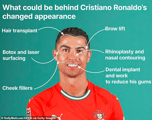纽约整形主任: C罗可能花25万整容, 包括牙齿、鼻梁、头发等