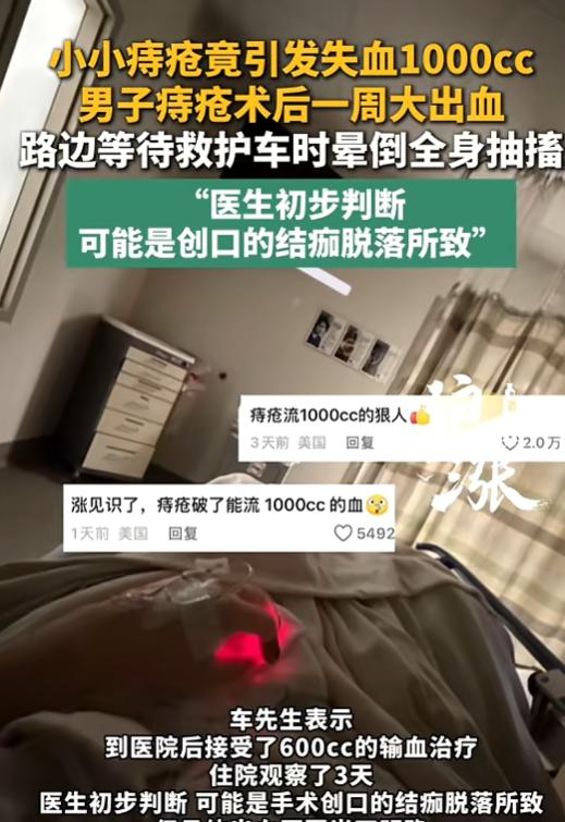 “太吓人了！”7月16日报道，美国洛杉矶，一男子做完痔疮手术一周后，突然在家血流