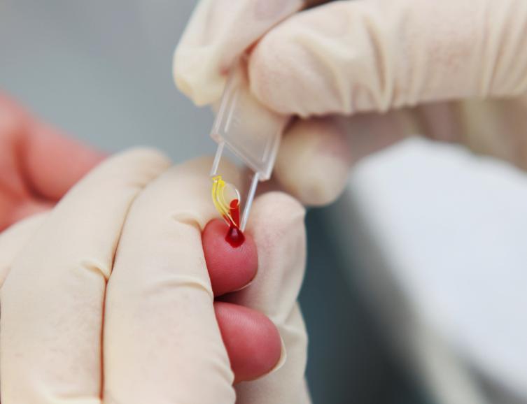 血型决定寿命长短？交通大学研究发现：癌症讨厌B型血！一听到“血型和寿命有关”