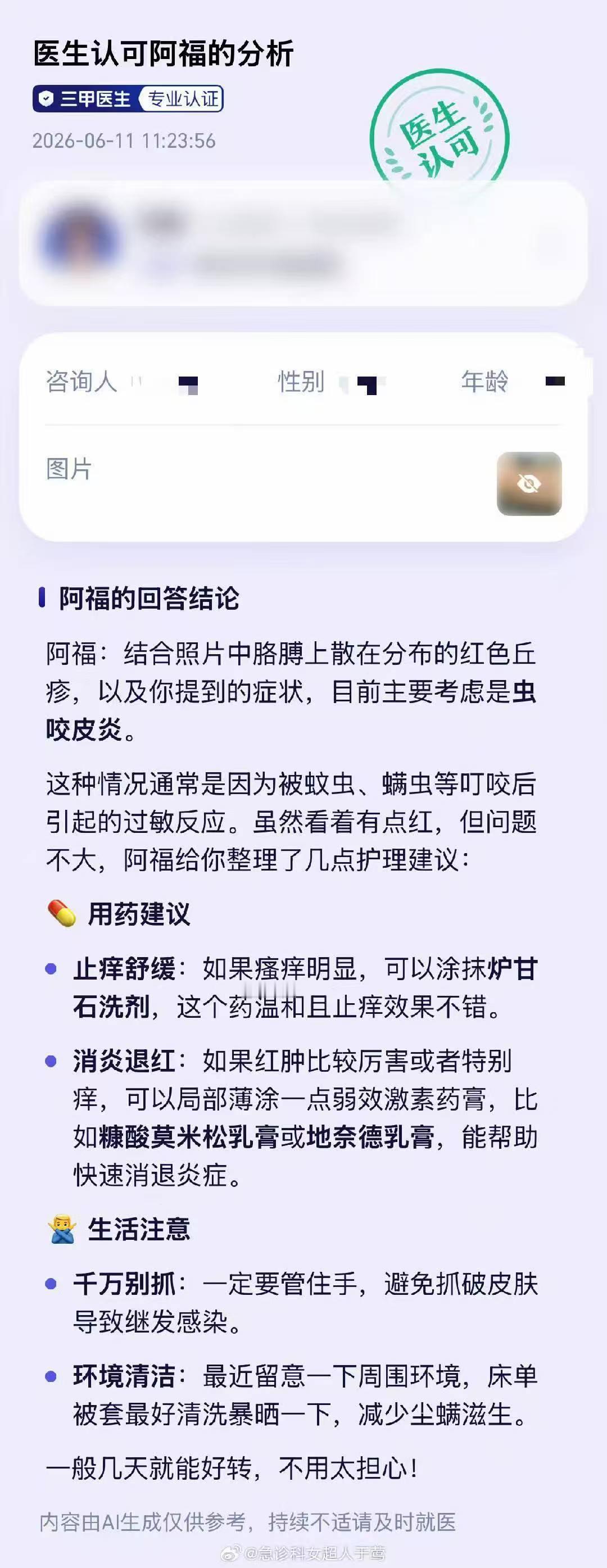 得了皮肤病一定不要自以为是不同体质对应不同治疗方式，照搬别人的护肤用药方式行不