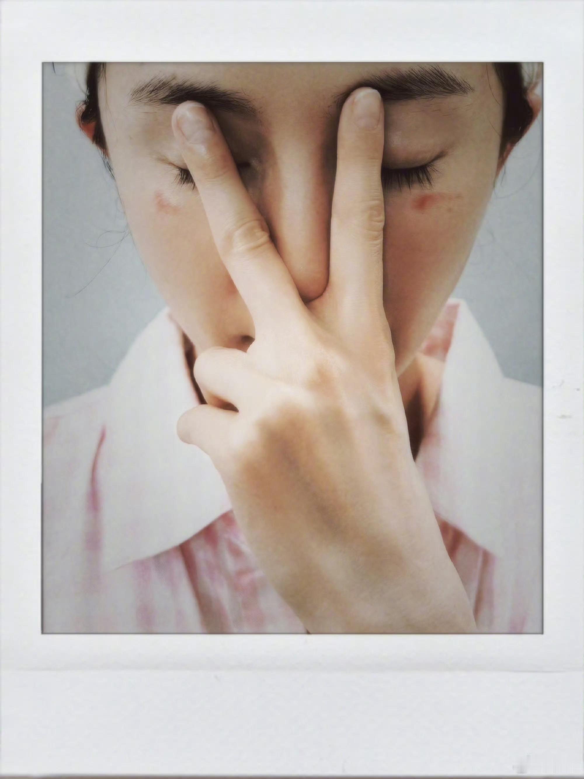 杨幂脸被蒸汽眼罩烫伤了我有时候难入睡的时候也会用，这个还是要注意的，有些很容易烫