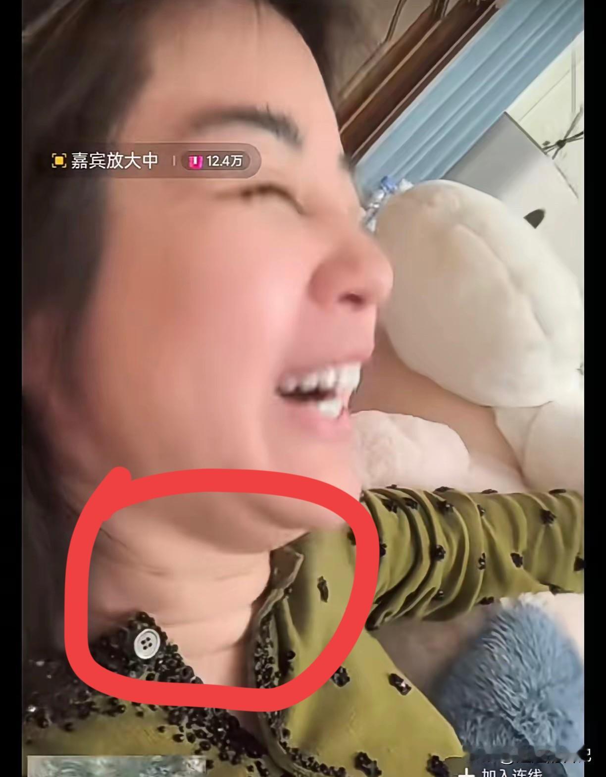 于文红的脖子皱纹太多了吧？这样看也太吓人了，那咋跟我一样，舍不得做脖子呢。于