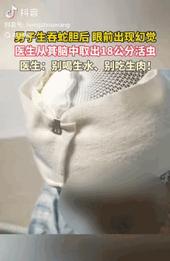 湖南一男子怎么也没想到，自己眼睛里时不时出现的异物感，看东西时闪过的