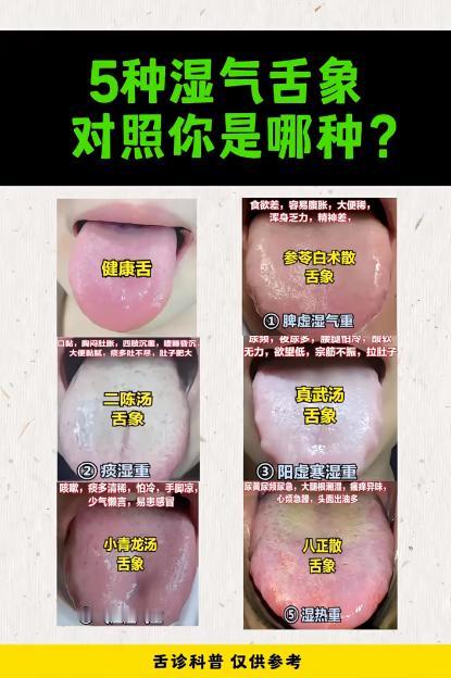 5种湿气舌象~对照你是哪一种