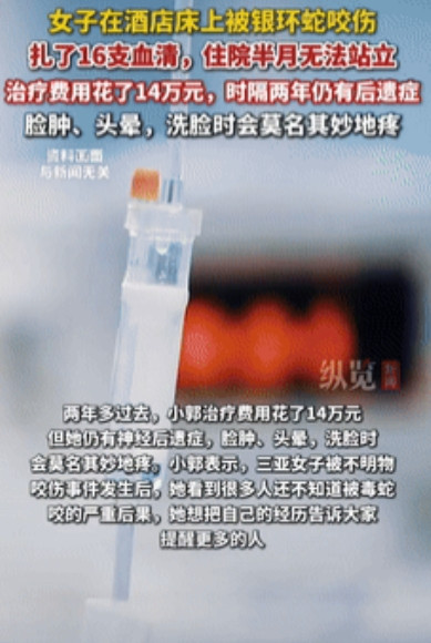 代价太大了！一女子在酒店的床上被银环蛇给咬伤，当时就到医院注射16支血清，本以为