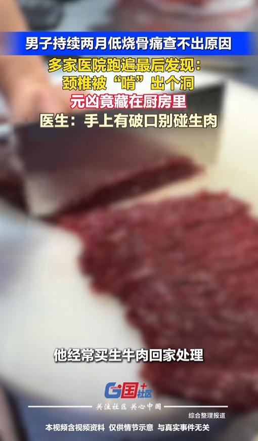 “万万没想到！”7月21日报道，一男子持续两月低烧骨痛，跑了多家医院都没查到原因