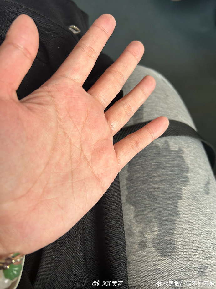 #月经弄脏卧铺涉事女生说很愧疚#【#月经弄脏卧铺事件当事人发声#】近日，“