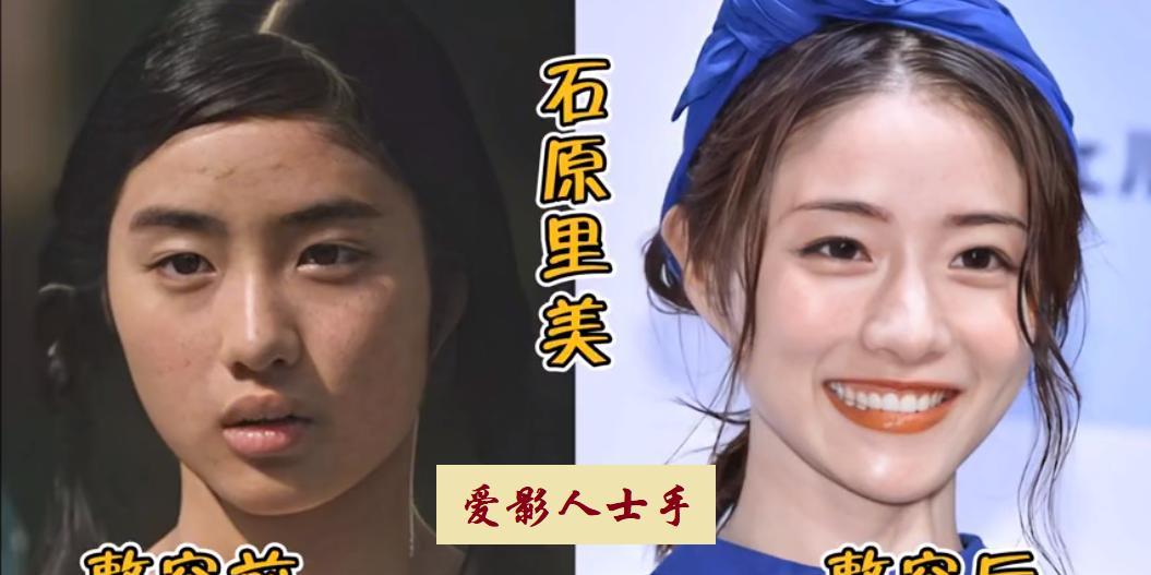 18位日本女星整容前后颜值对比，新垣结衣牙齿变整齐了，颜值一下提升很多，石原里美