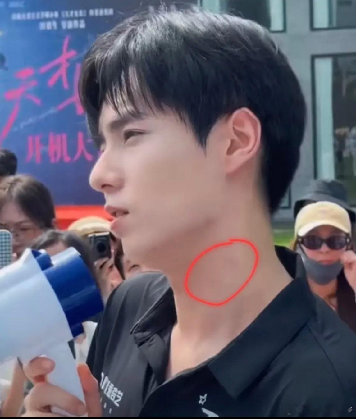 网友发现天才女友开机的时候胡一天脖子上疑似有吻痕​​​