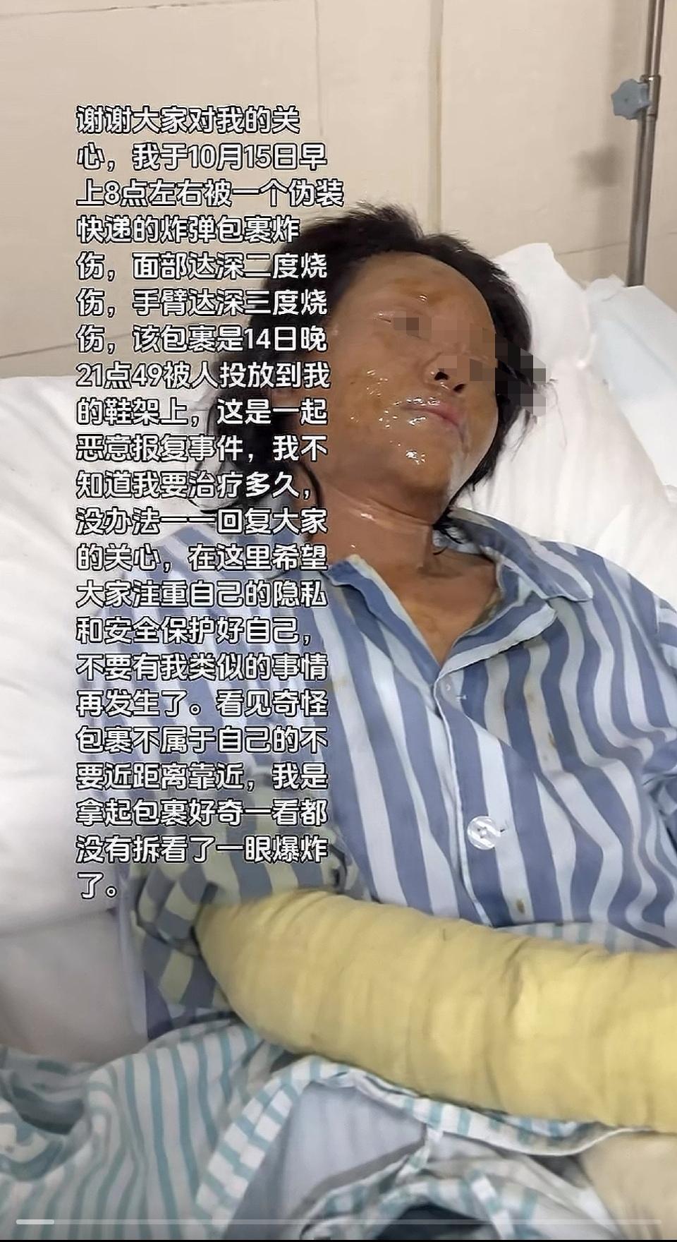 太可怕了！湖南一女主播被快递炸伤严重！该女主播是湖南永州的，年龄29岁，粉丝7