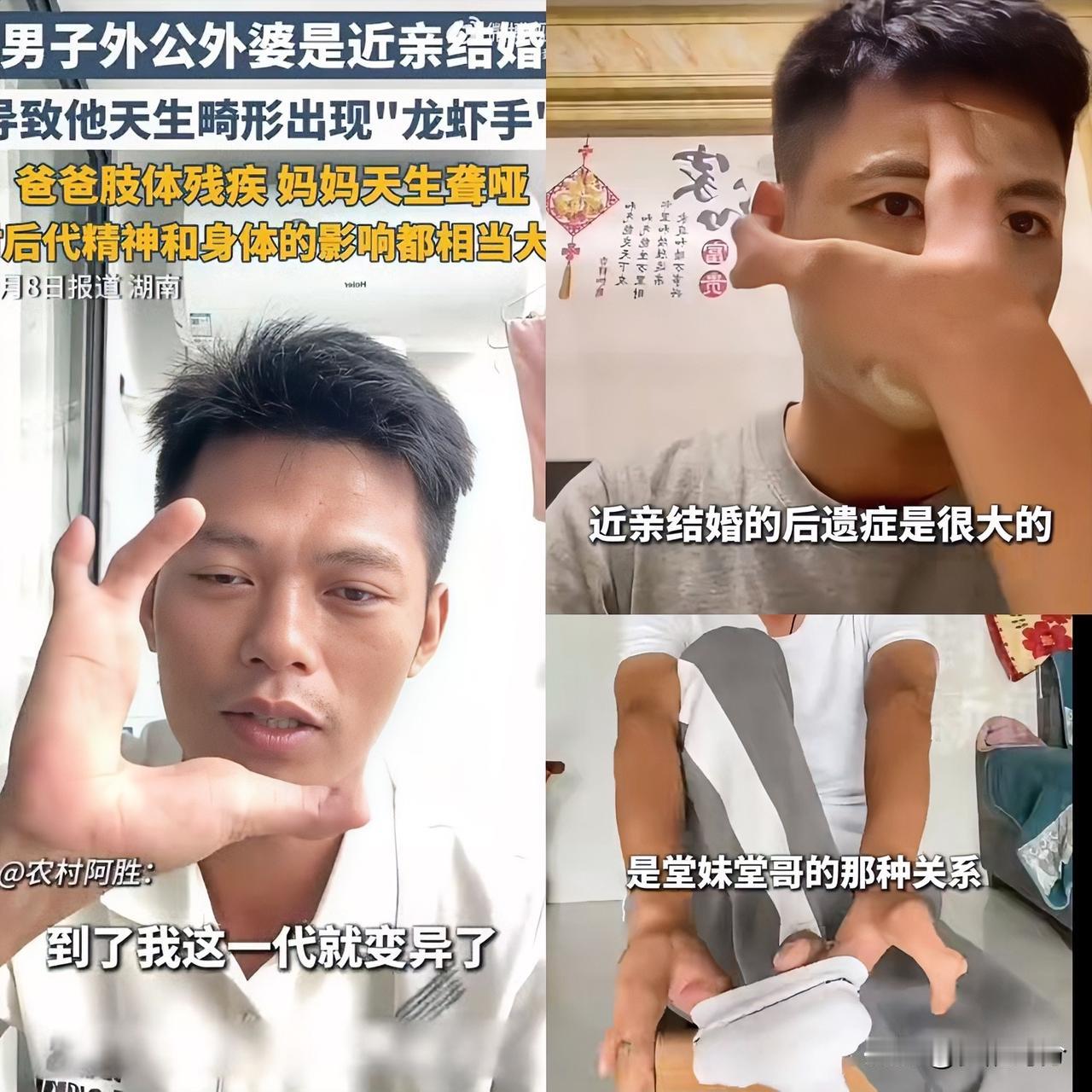 真是丧心病狂都这样了还要结婚生子！湖南一90后男子因外公外婆近亲结婚，导