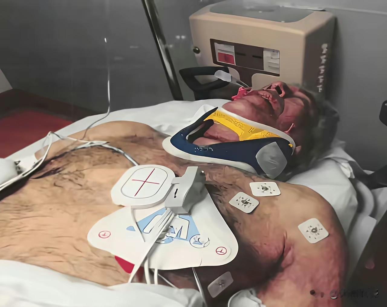 爱泼斯坦死的时候应该是66岁，看看他这强壮的身体，根本就不像是66岁的样子。现在