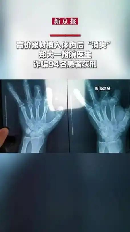 触目惊心！医生竟把吻合器缝进患者体内骗回扣，连1岁婴儿都不放过！四年黑幕曝光，监