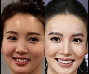 #金晨脸部状态#也没什么变化，主要是底子好