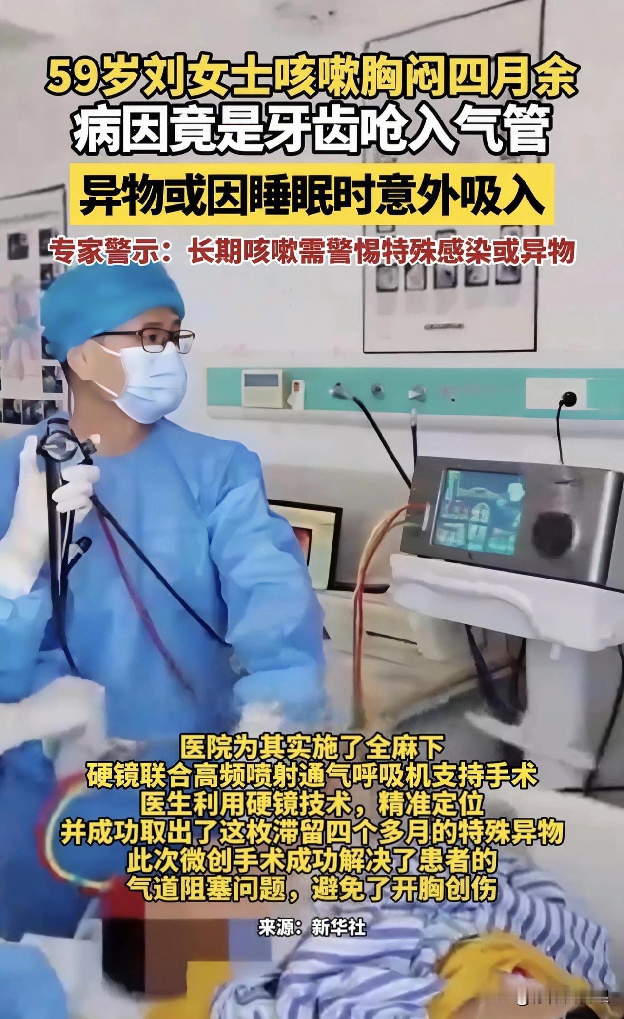 女子咳嗽4个月查不出原因，医生竟从气道里掏出一颗牙！家人们谁懂啊！刘女士被咳嗽