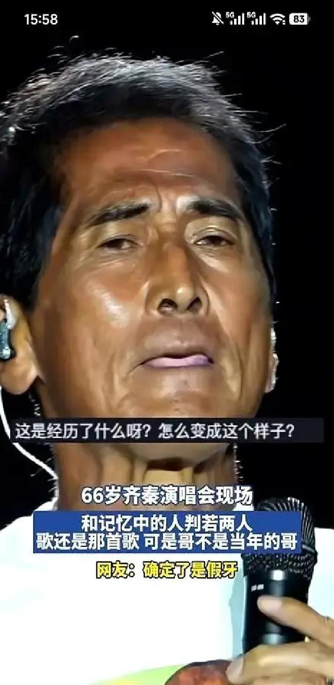 62岁的张学友在台上摔倒，但他没有停下演唱。他从小就带着耳水不平衡的老毛病，